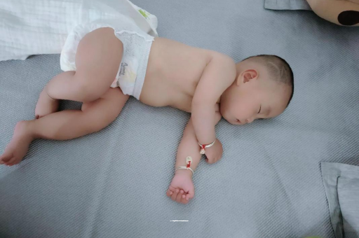 安达六个月宝宝眼睛散光 安达六个月宝宝眼睛散光